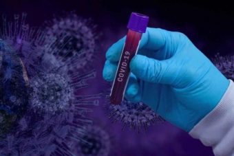 Στις 309 οι νέες μολύνσεις SARS-COV 2 στη Δυτική Μακεδονία για την Πέμπτη 3 Φεβρουαρίου
